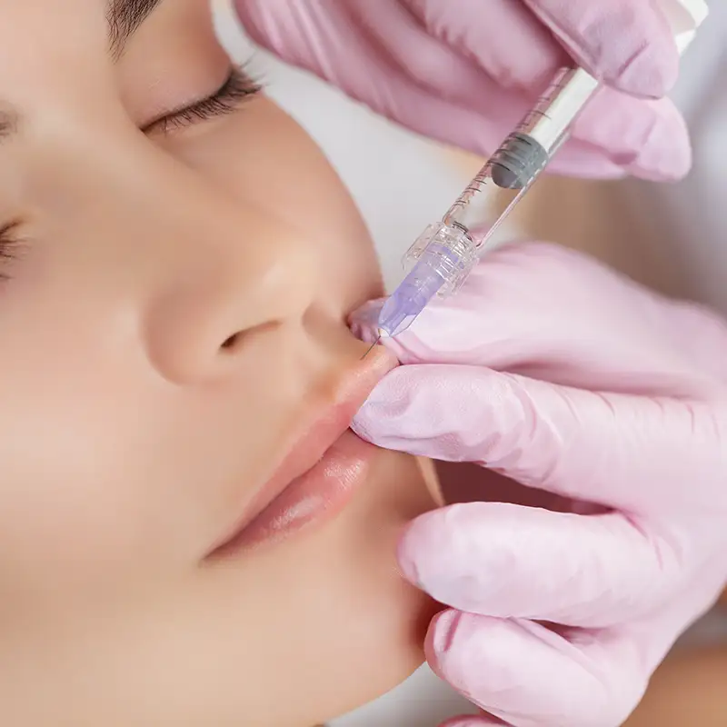 Dermal Fillers