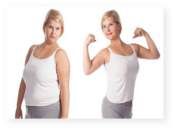http://Weight%20Loss%20Management
