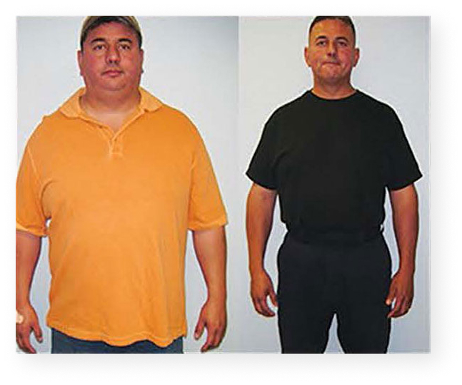http://Weight%20Loss%20Management